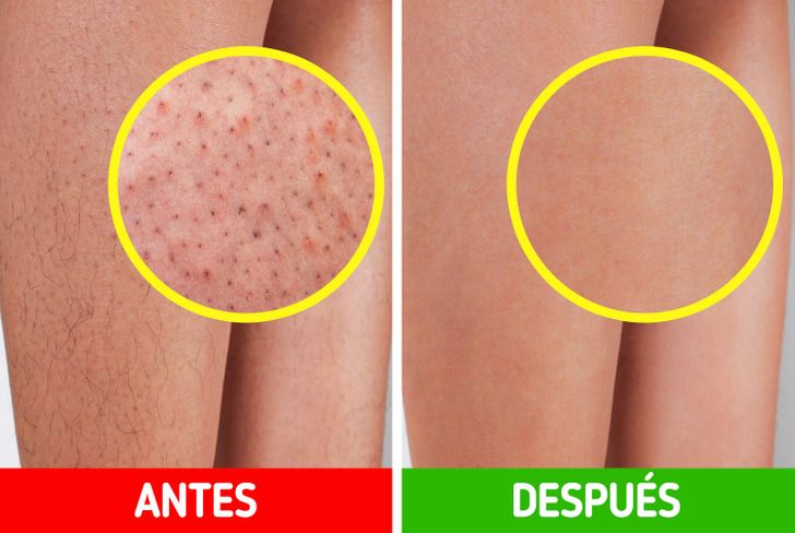 TRULY AFTER SHAVE ACEITE